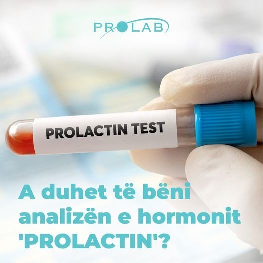 Prolaktina