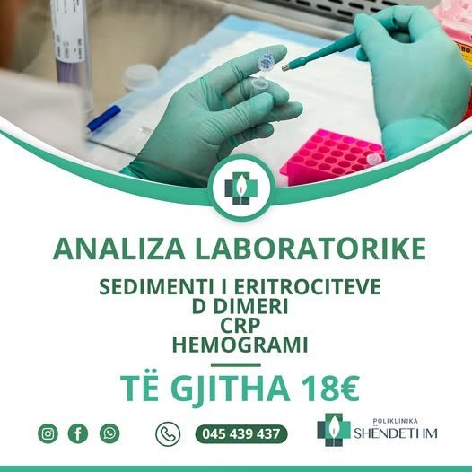 analiza laboratorike