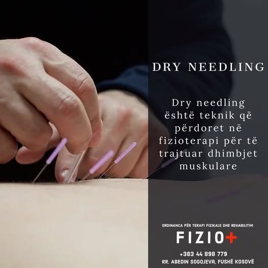 Dry needling