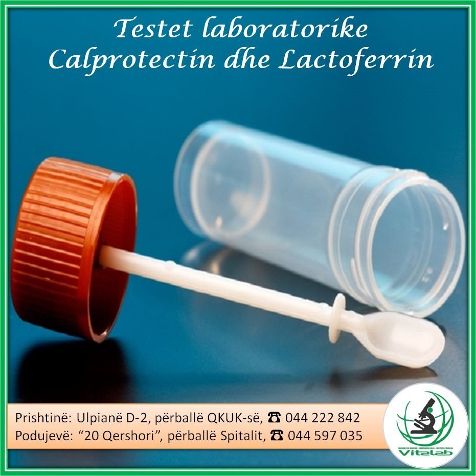 TESTET LABORATORIKE CALPROTECTIN DHE LACTOFERRIN