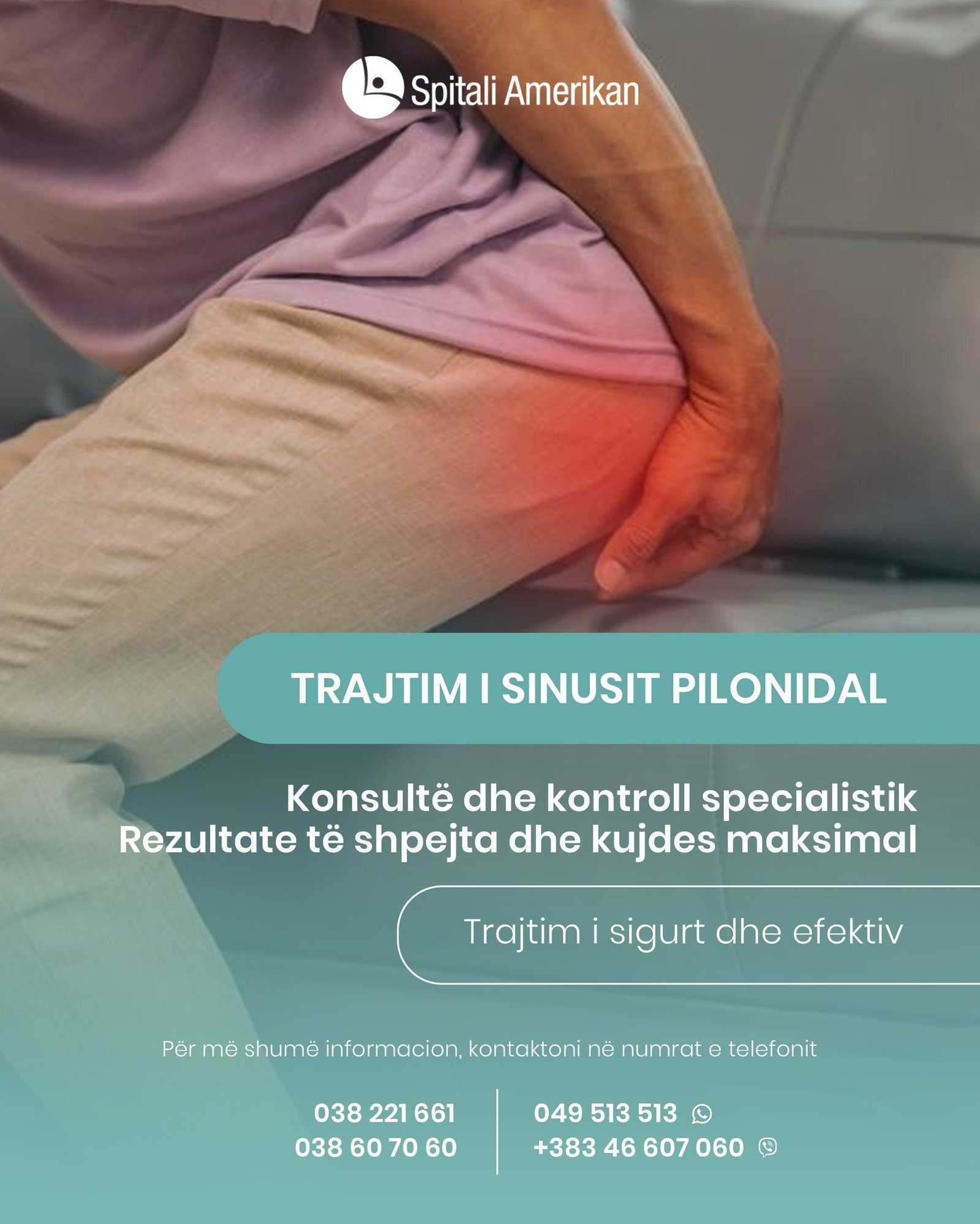 Sinusi pilonidal është një problem i shpeshtë