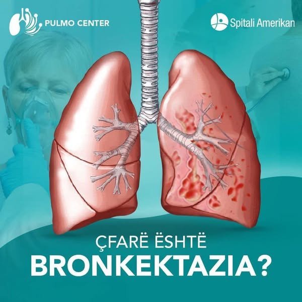 Bronkektazia