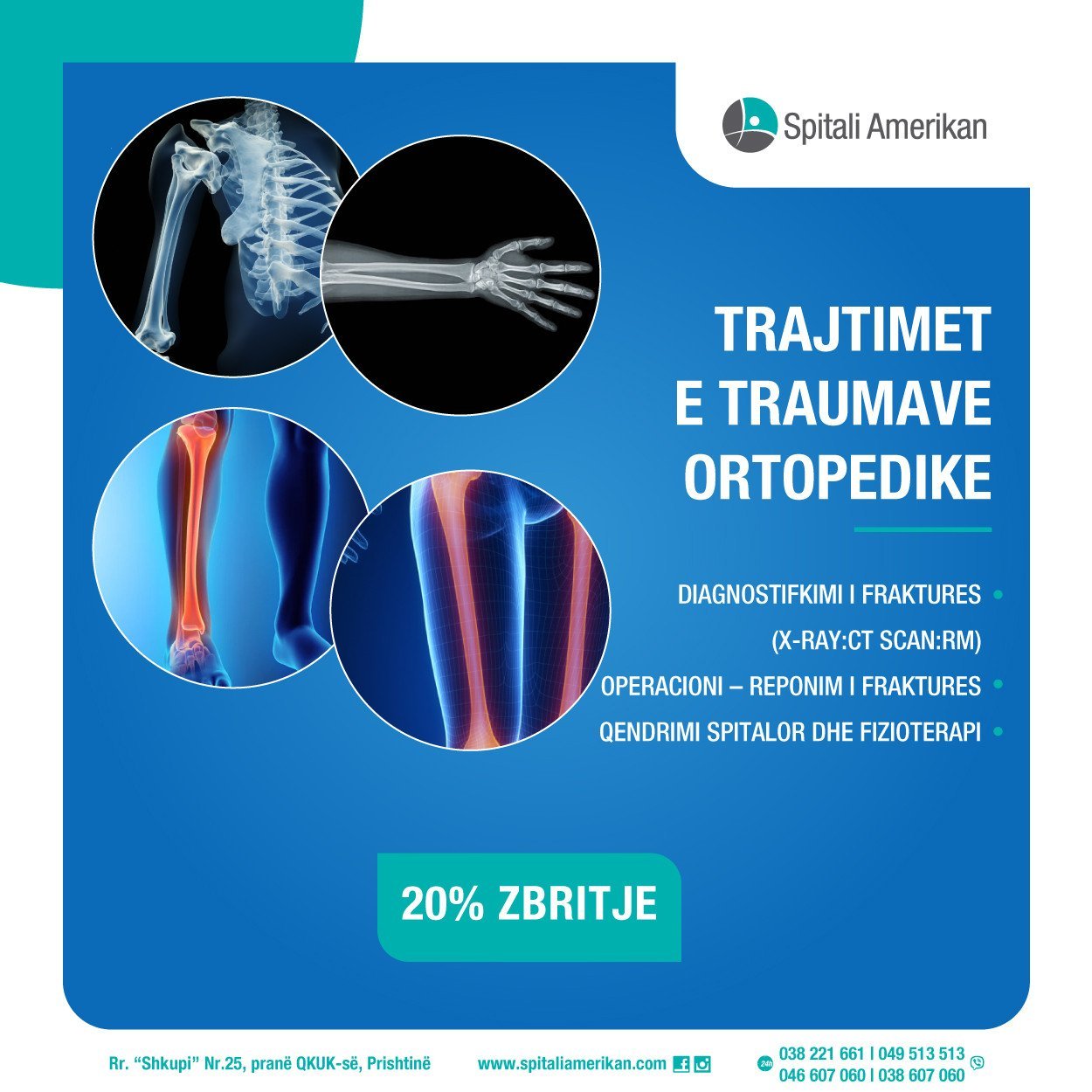 Trajtimet e Traumave Ortopedike – Tani me 20% ZBRITJE!