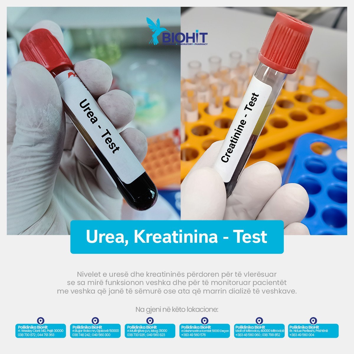 Urea dhe kreatinina