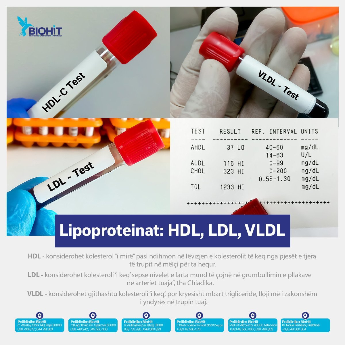 Lipoproteinat: HDL, LDL, VLDL