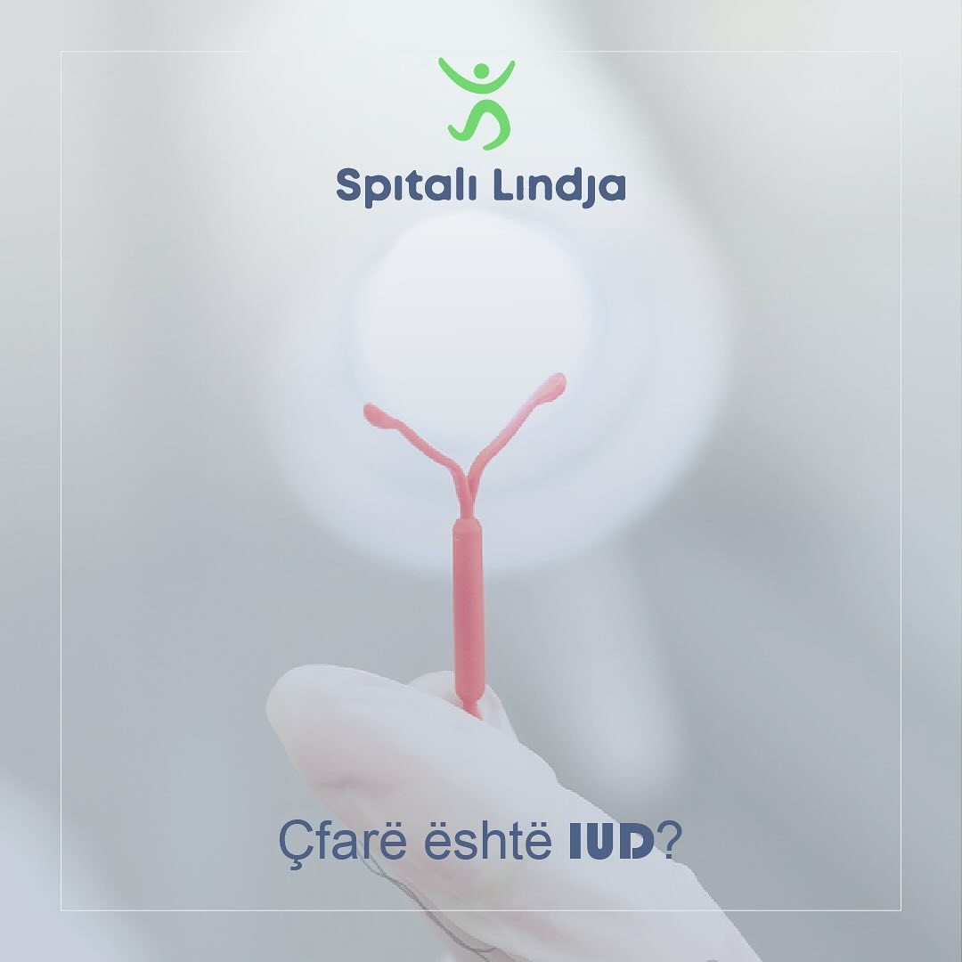 IUD (Intrauterine Device) është një pajisje që vendoset brenda mitrës për të parandaluar shtatzëninë