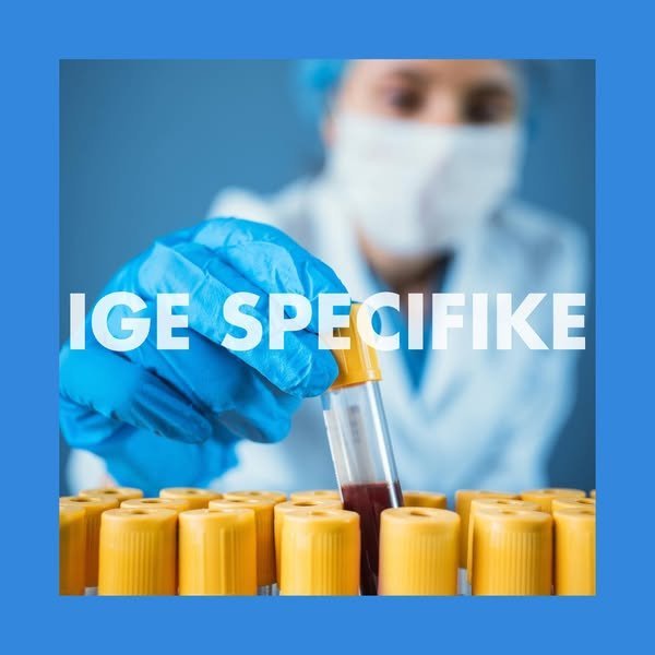 IGE Specifike