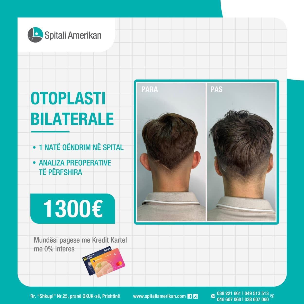 Otoplasti bilaterale