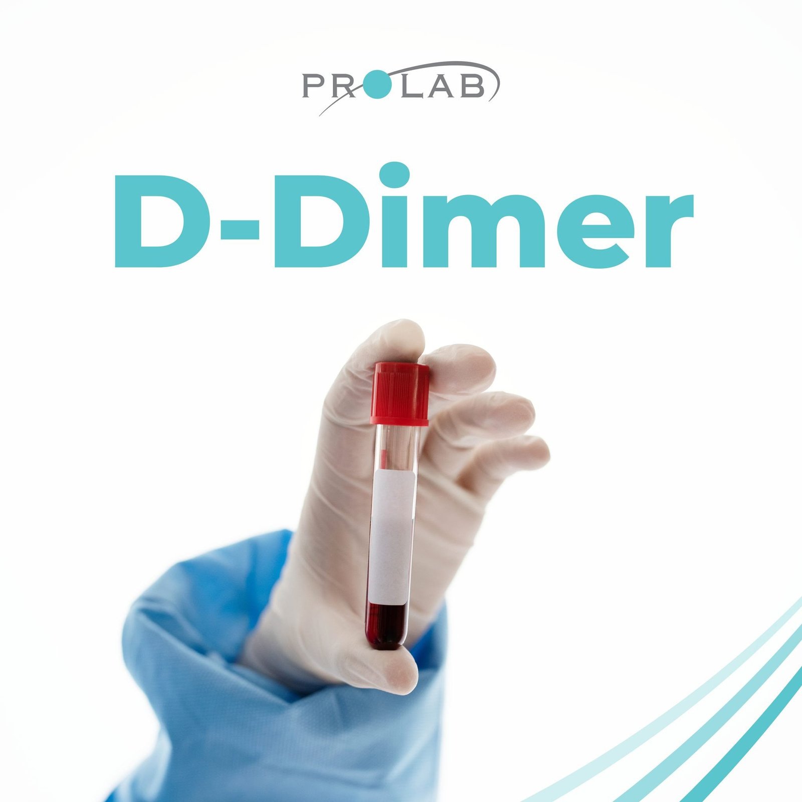 D -Dimer