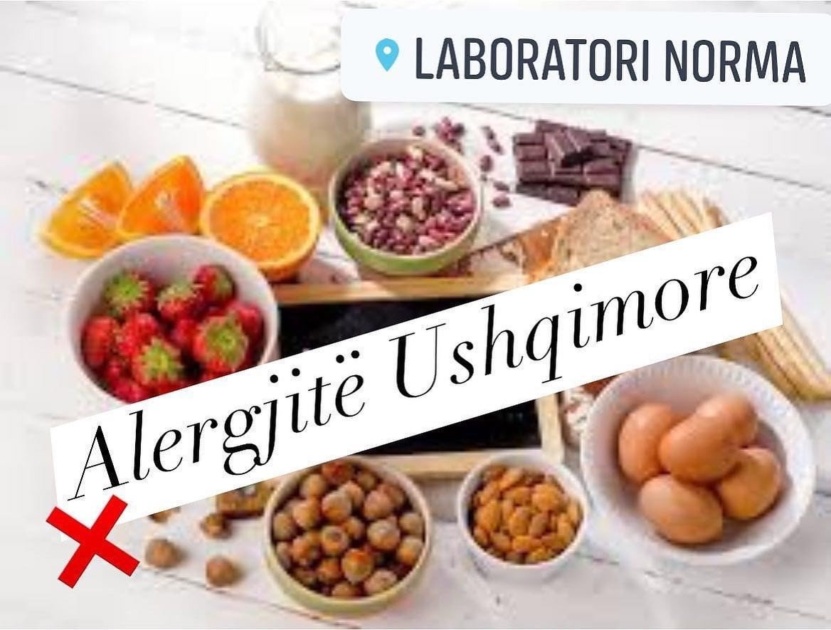 Alergjitë ushqimore