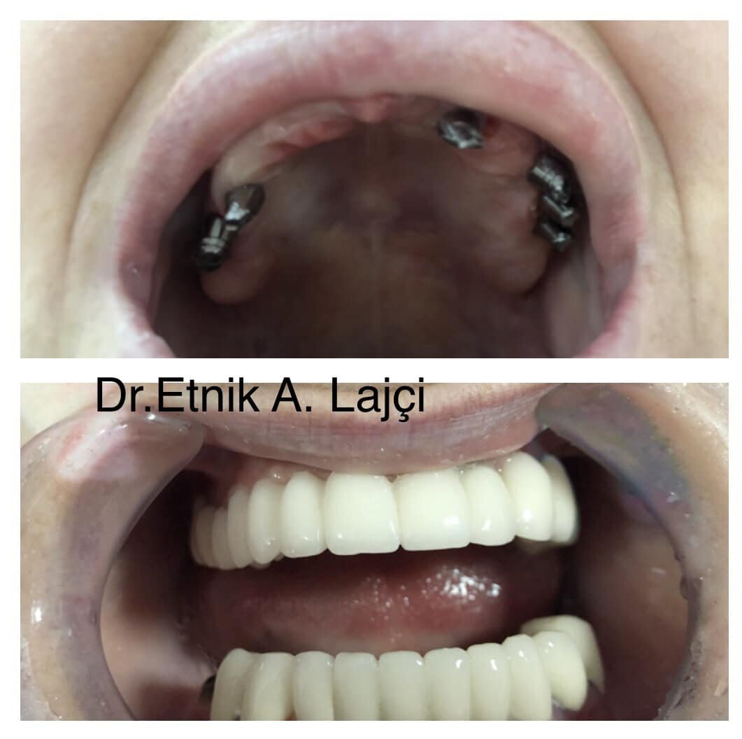Rregullimi