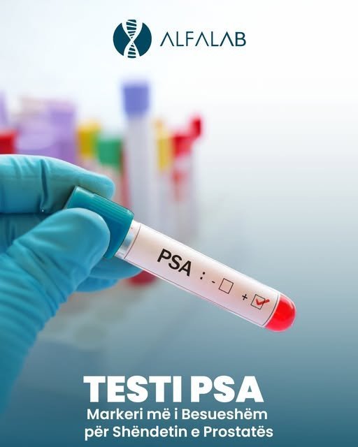 Testi PSA