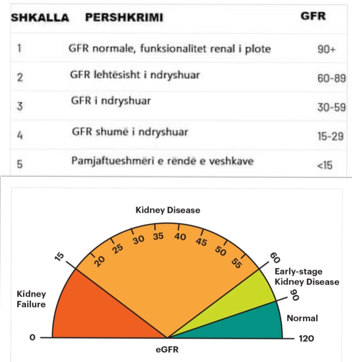 GFR - Shkalla e Filtrimit Glomerular (Glomerular Filtration Rate)