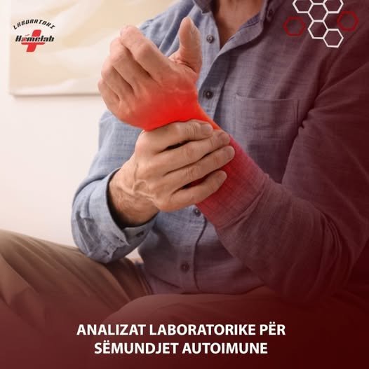 Sëmundjet autoimune