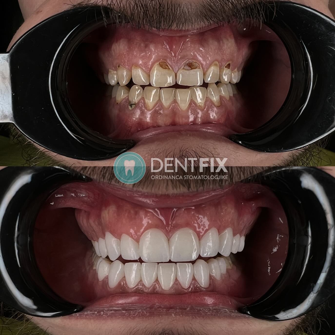 Before and after