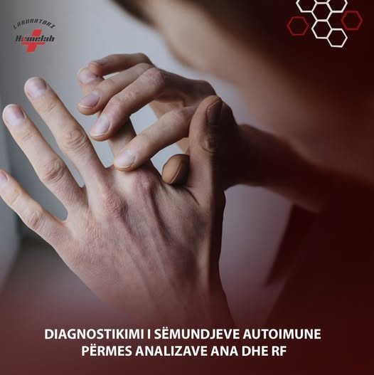 Diagnostikimi i sëmundjeve autoimune
