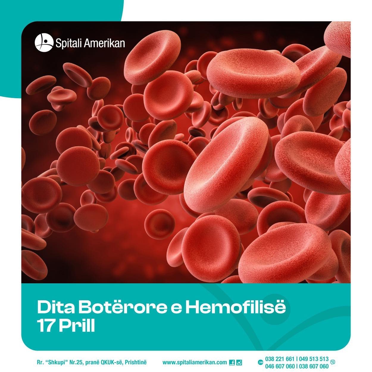Dita Botërore e Hemofilisë shënohet çdo vit më 17 prill