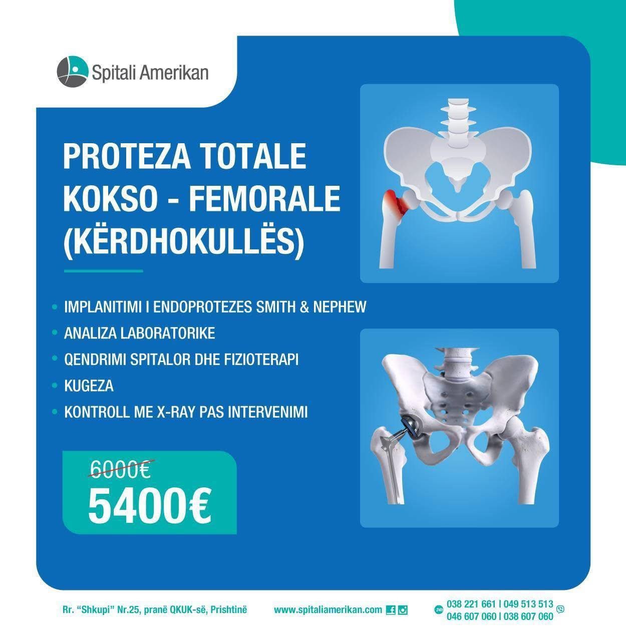 Proteza Totale e Gjurit – Tani me Çmim të Ri 5400€!