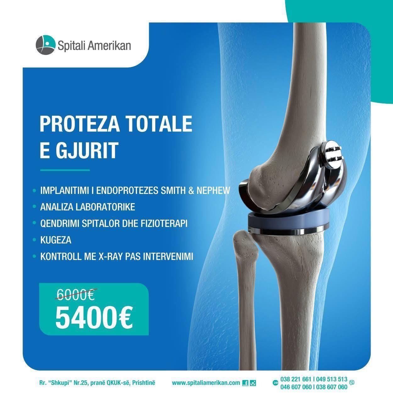 Proteza Totale e Gjurit – Tani me Çmim të Ri 5400€!