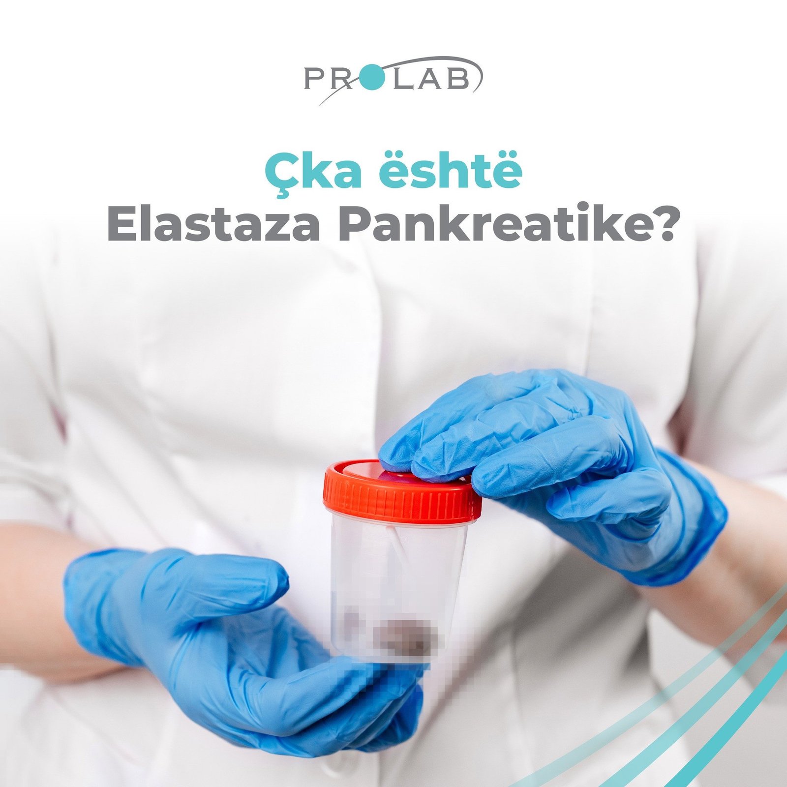 Çka elastaza pankreatike?