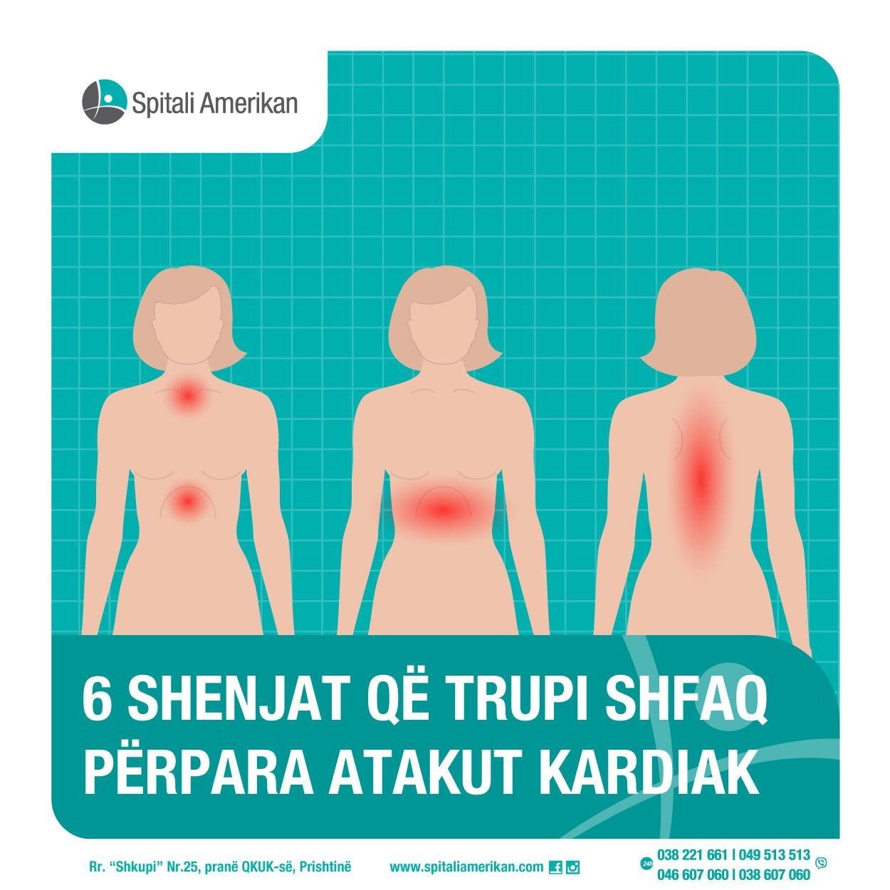 6 shenjat që trupi shfaq përpara atakut kardiak