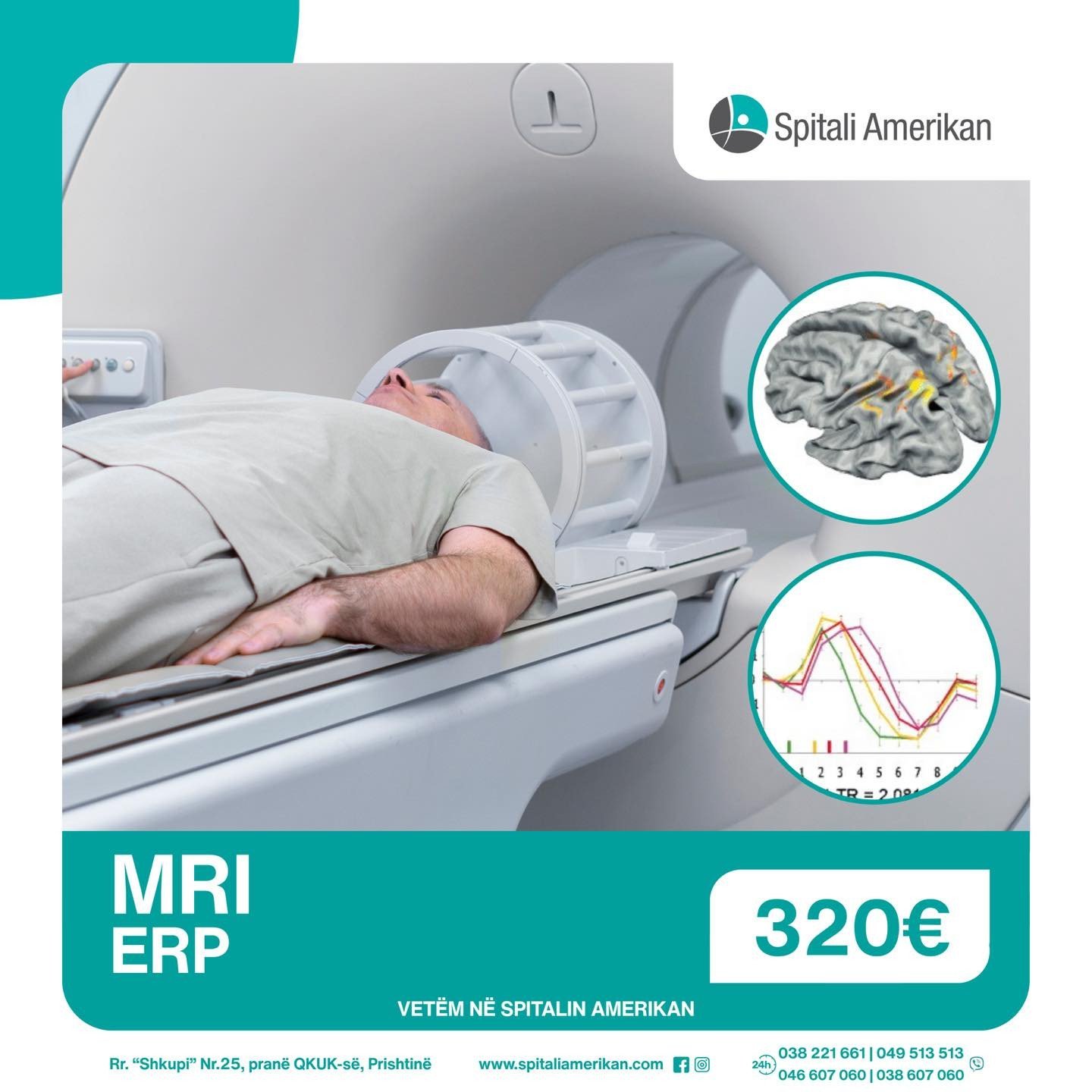 MRI (Rezonanca Magnetike) + ERP për vetëm 320€
