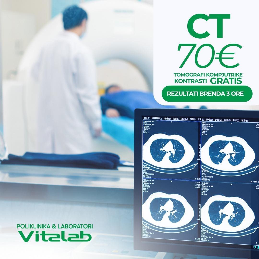 CT e një pjese te trupit në zbritje 70€ si dhe kontrasti gratis në Klinikën Vitalab