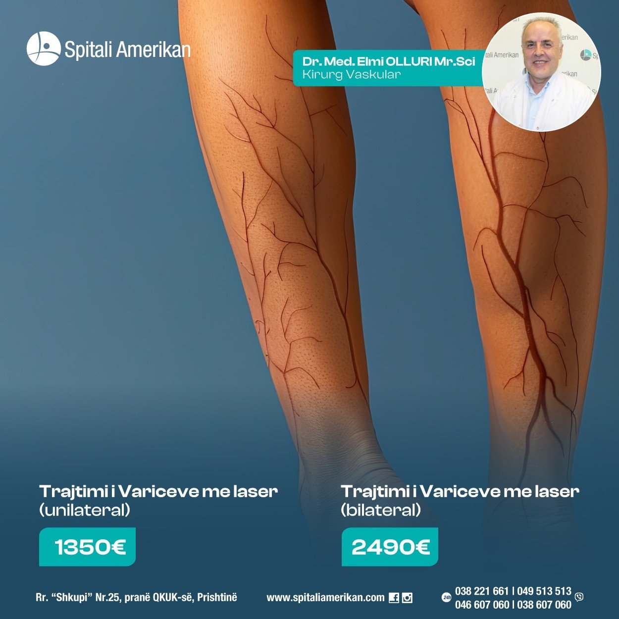 Spitali Amerikan në Kosovë ofron trajtim të variceve me laser