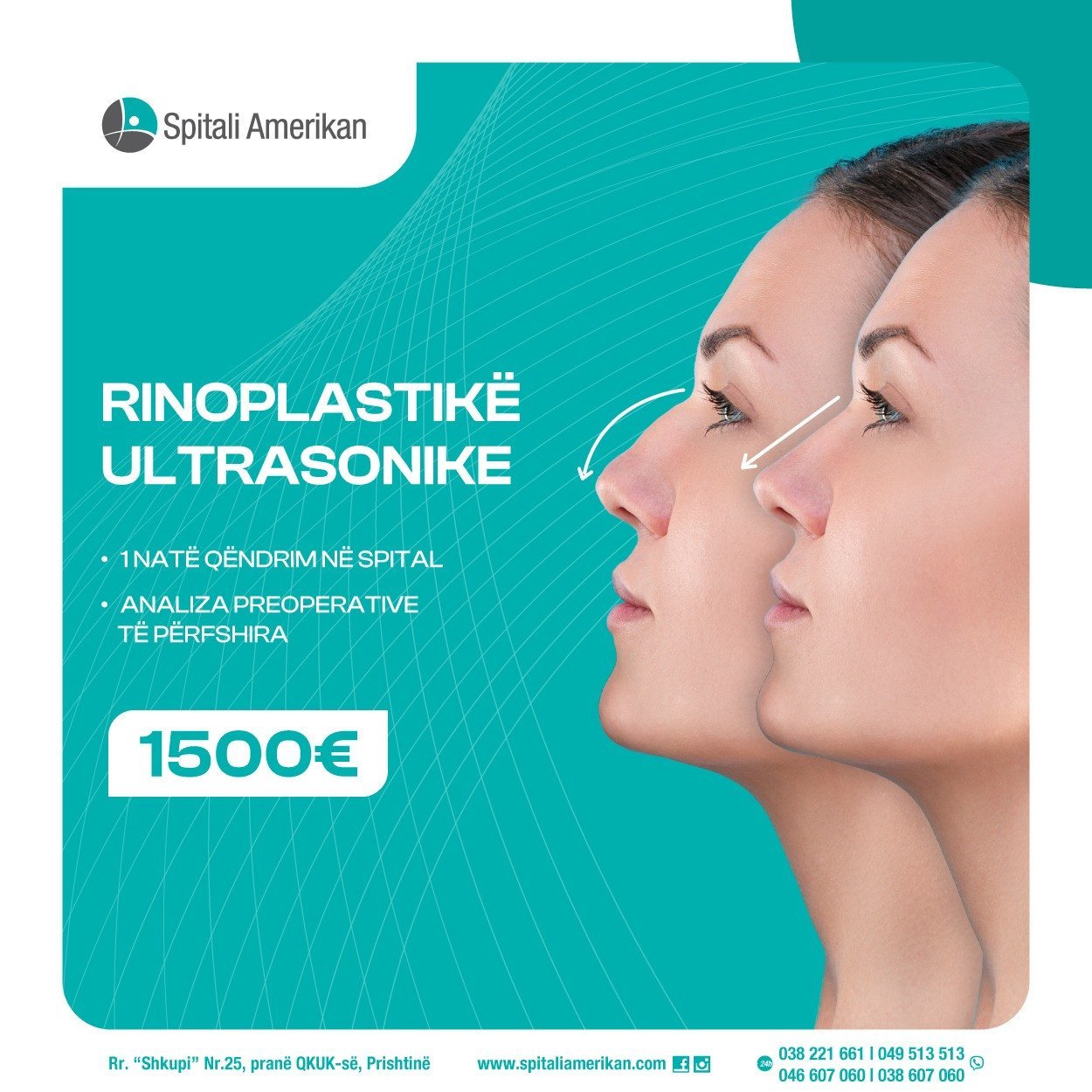 RINOPLASTIKË ULTRASONIKE – ÇMIM PROMOCIONAL