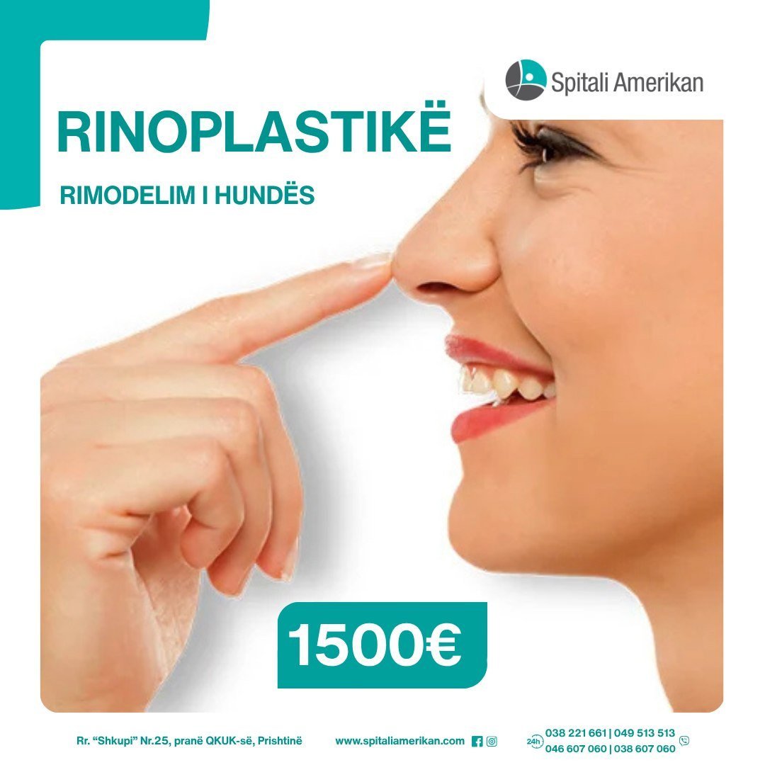 RINOPLASTIKË (rimodelim i hundës)RINOPLASTIKË