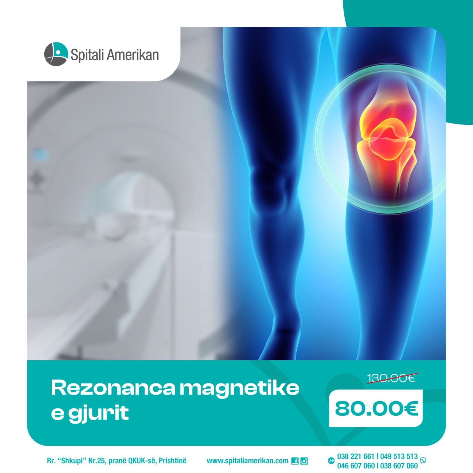Ndjeni dhimbje, ngurtësi apo kërcitje në gju?