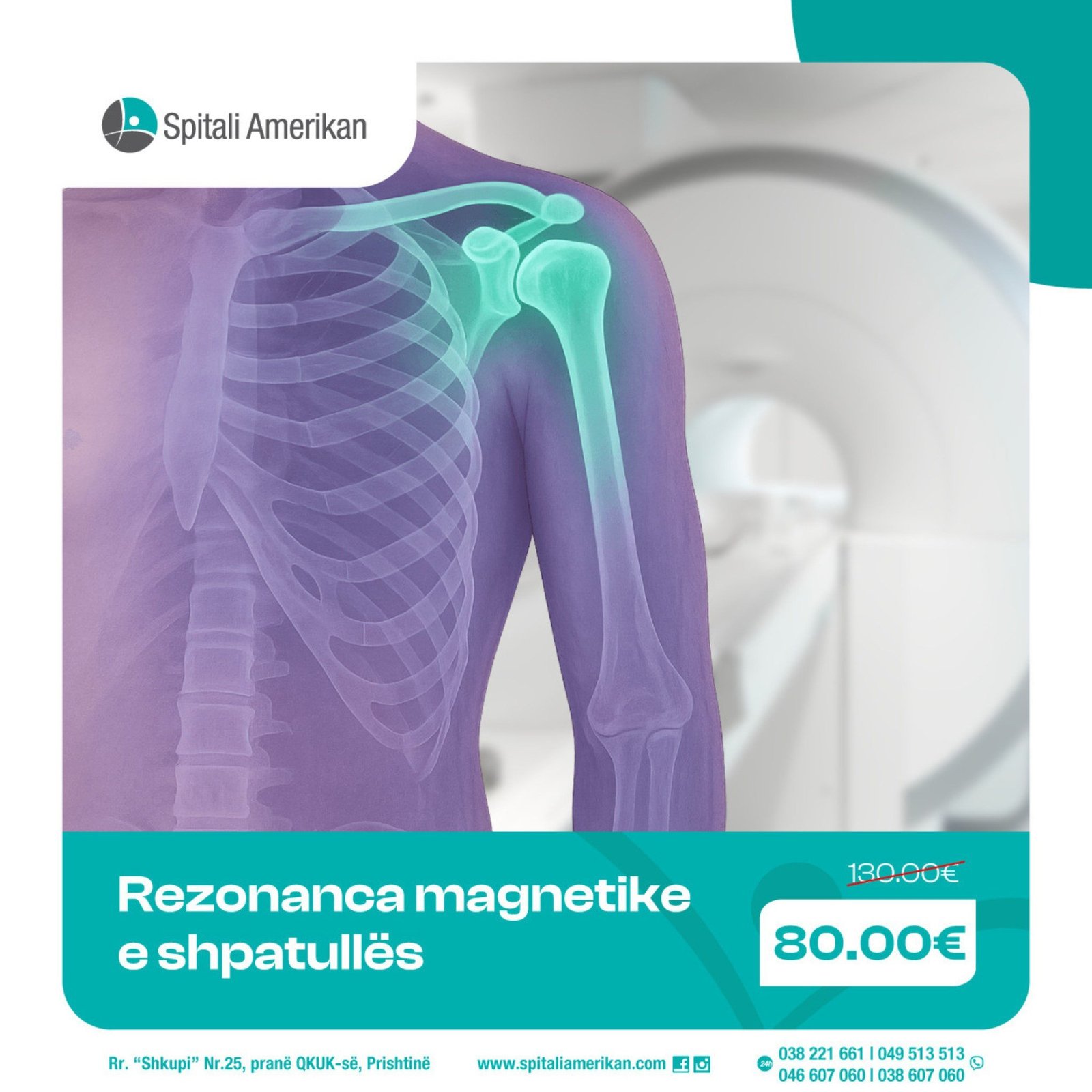 Keni dhimbje ose shqetësime në shpatull?