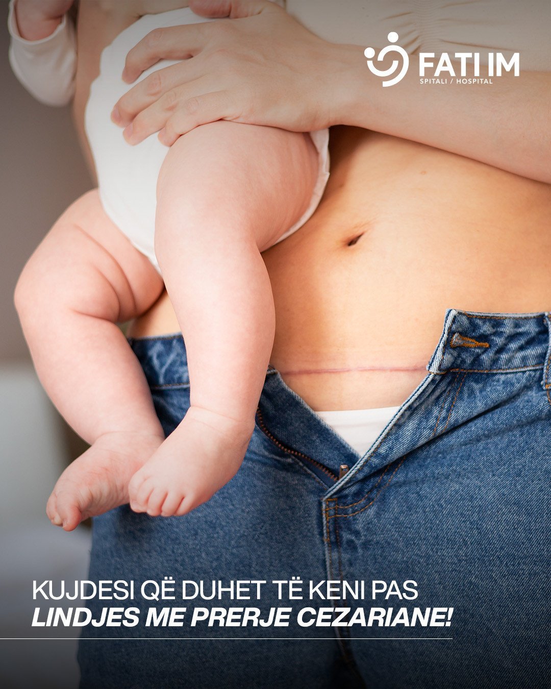 KUJDESI QË DUHET TË KENI PAS LINDJES ME PRERJE CEZARIANE!