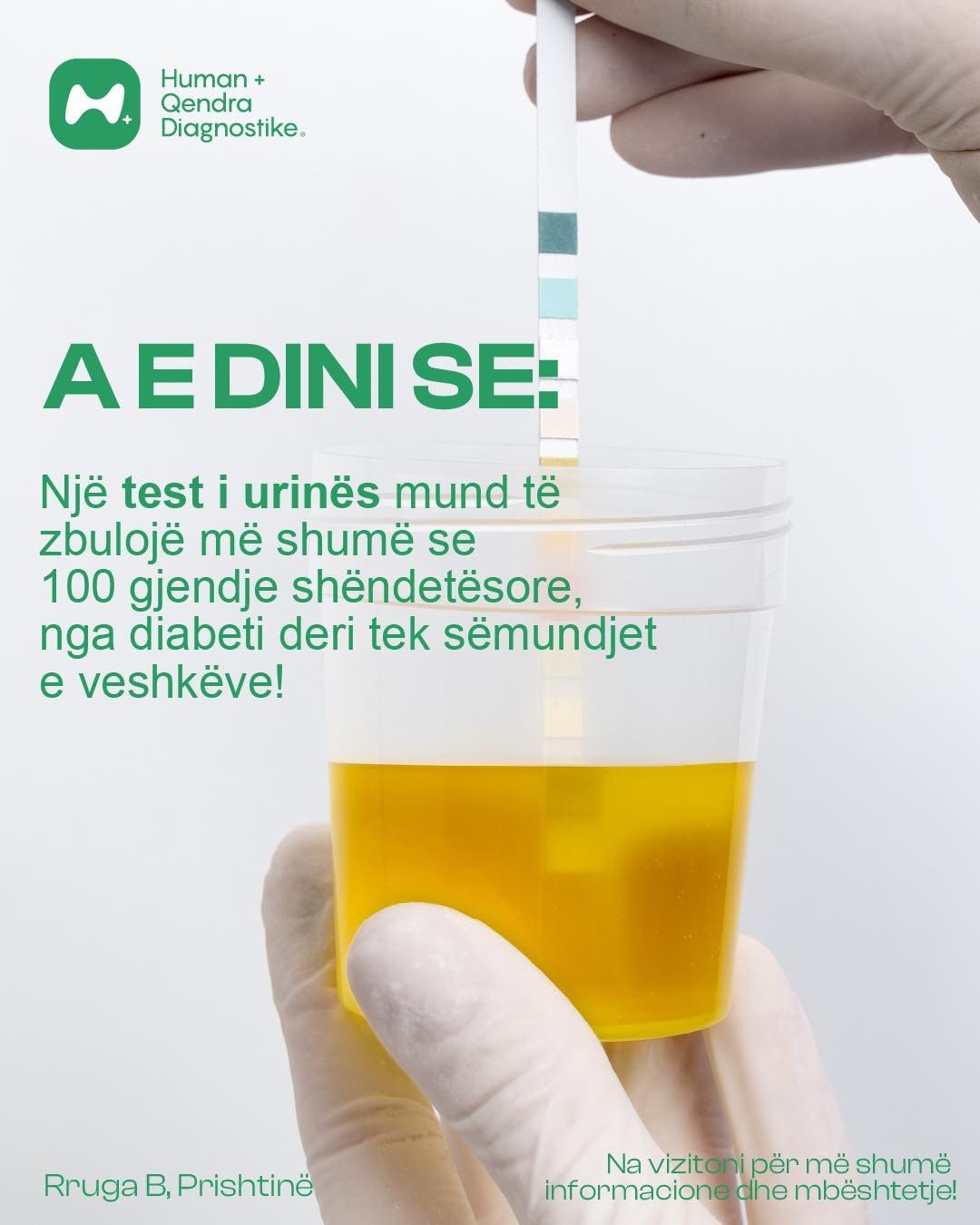 A e dini se një test i urinës mund të zbulojë mbi 100 gjendje shëndetësore