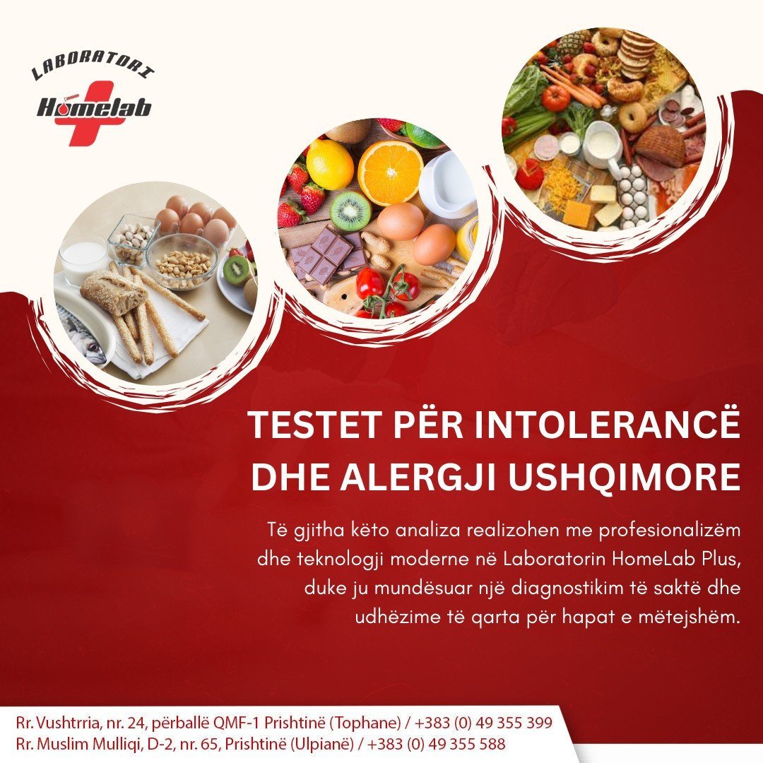 Testet për intolerancë dhe alergji ushqimore
