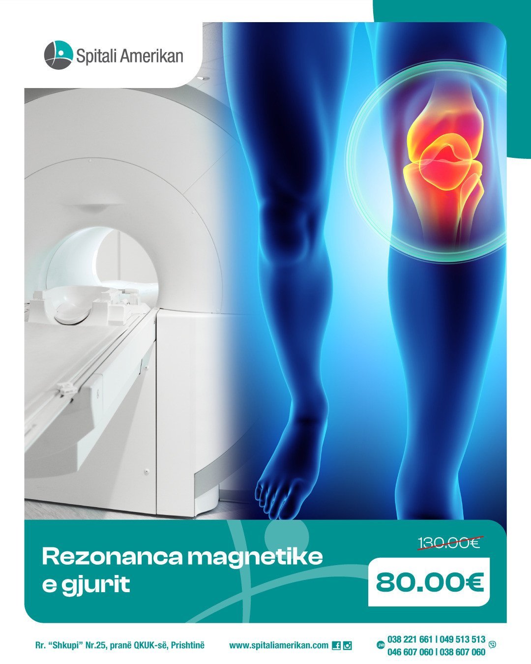 Ndjeni dhimbje, ngurtësi apo kërcitje në gju?
