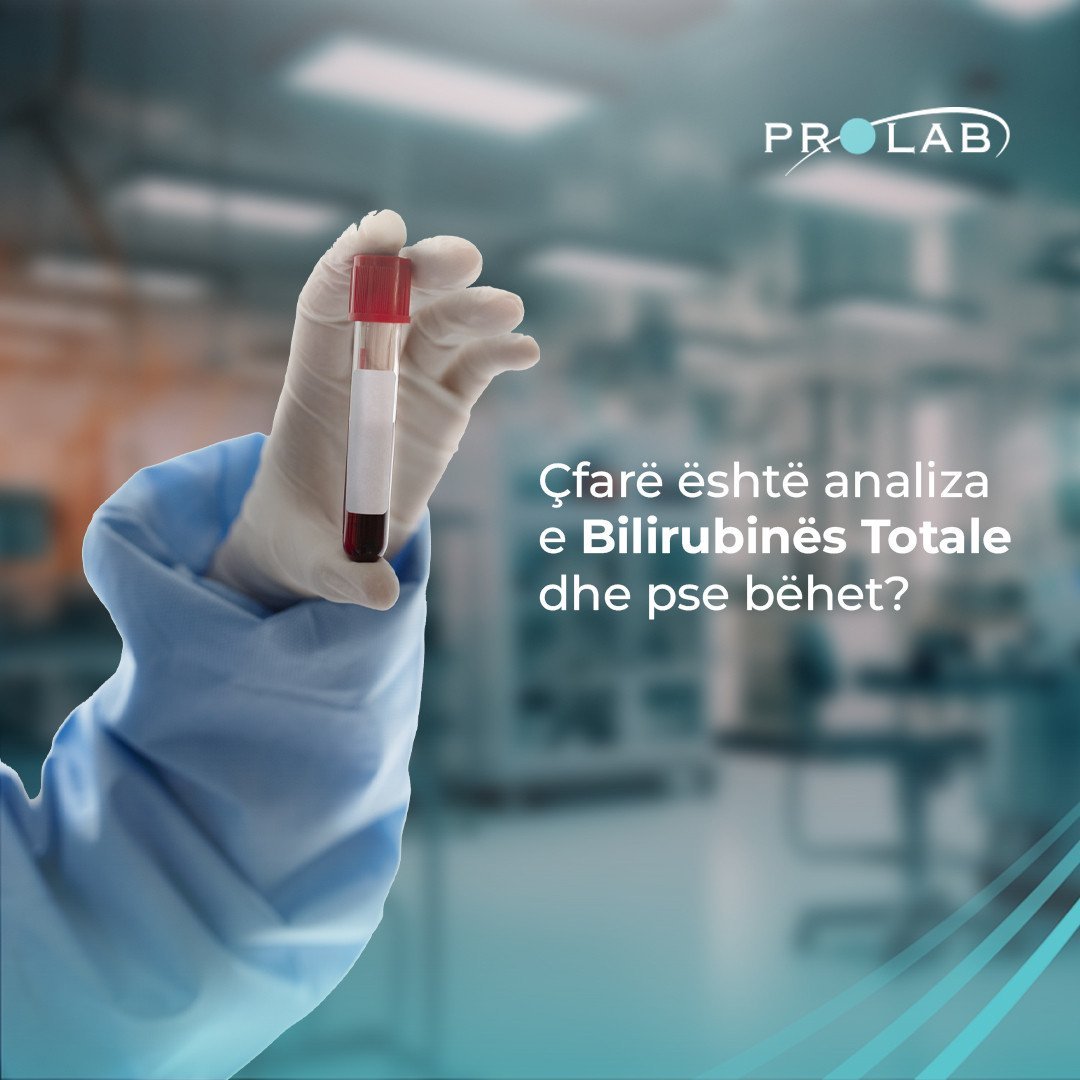 Çfarë ësht bilirubina totale?