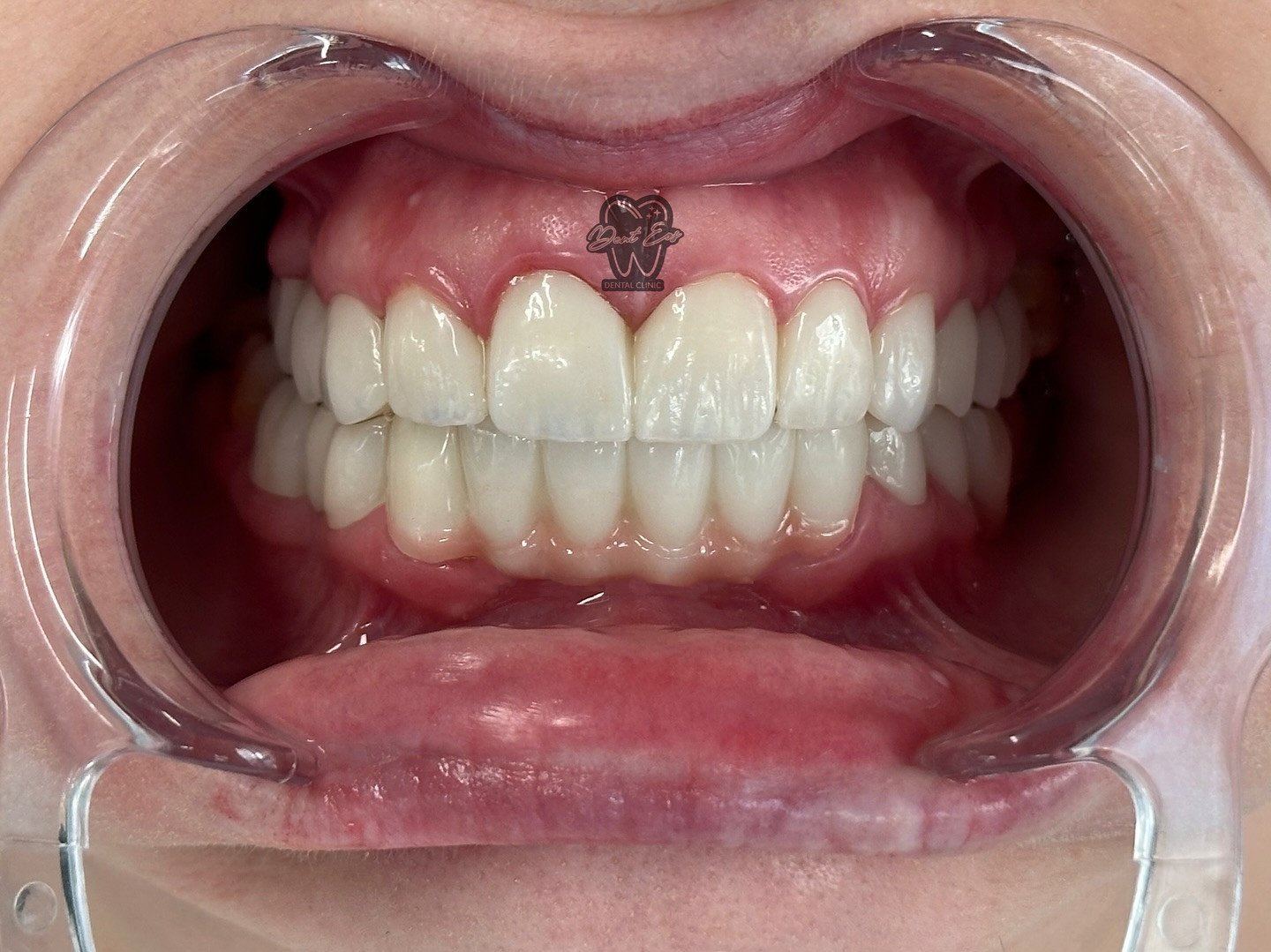 Swipe for transformation