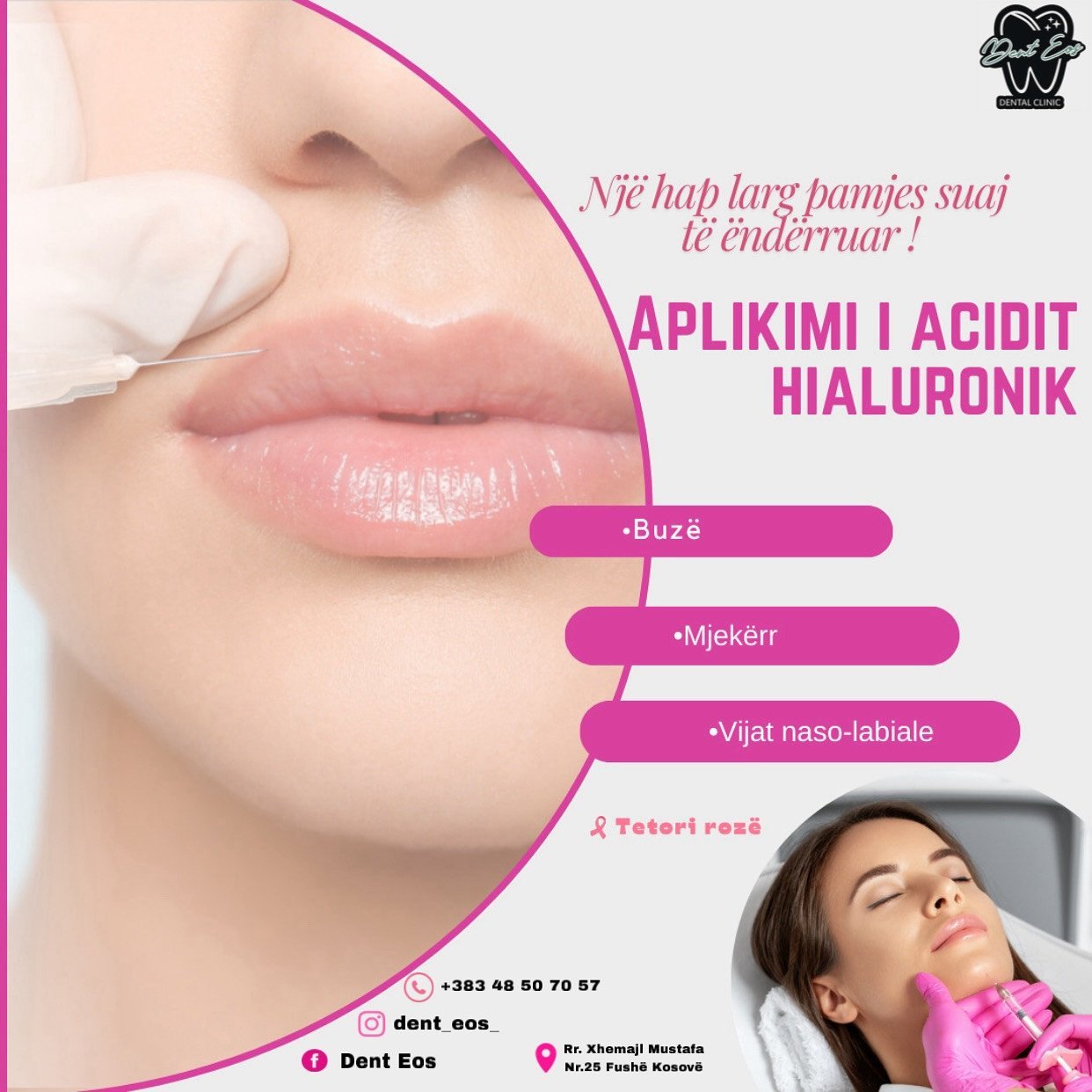 Aplikimi i acidit hialuronik