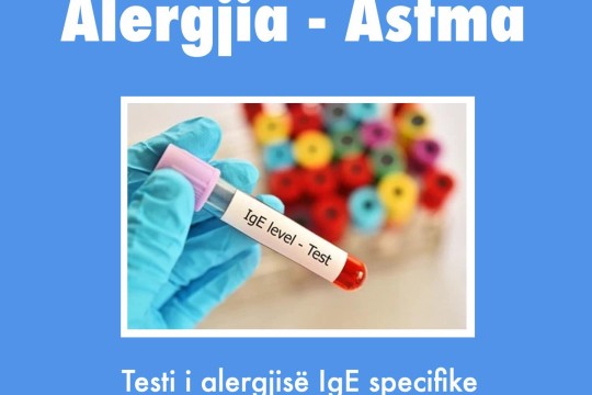 Alergjia-Astma - Test i alergjise lgE specifike