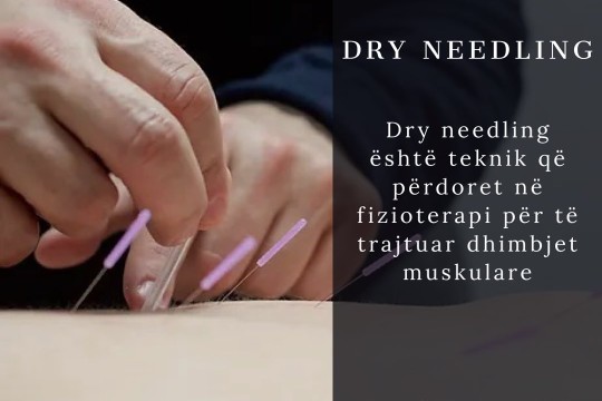 Fizio+ - Dry needling