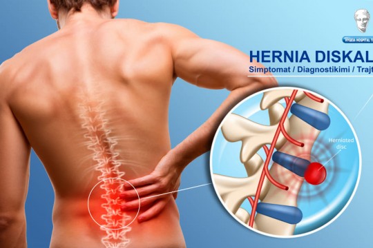Spina Center -Simptomet e Dhimbjës dhe Mpirjës në Këmbë